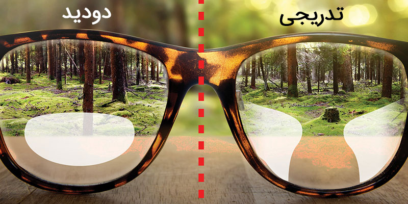 همه چیز در مورد عدسی های طبی و انواع آن